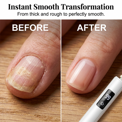 💅✨ Professional Electric Nail Polisher – Salon-Quality Manicure at Home 💎