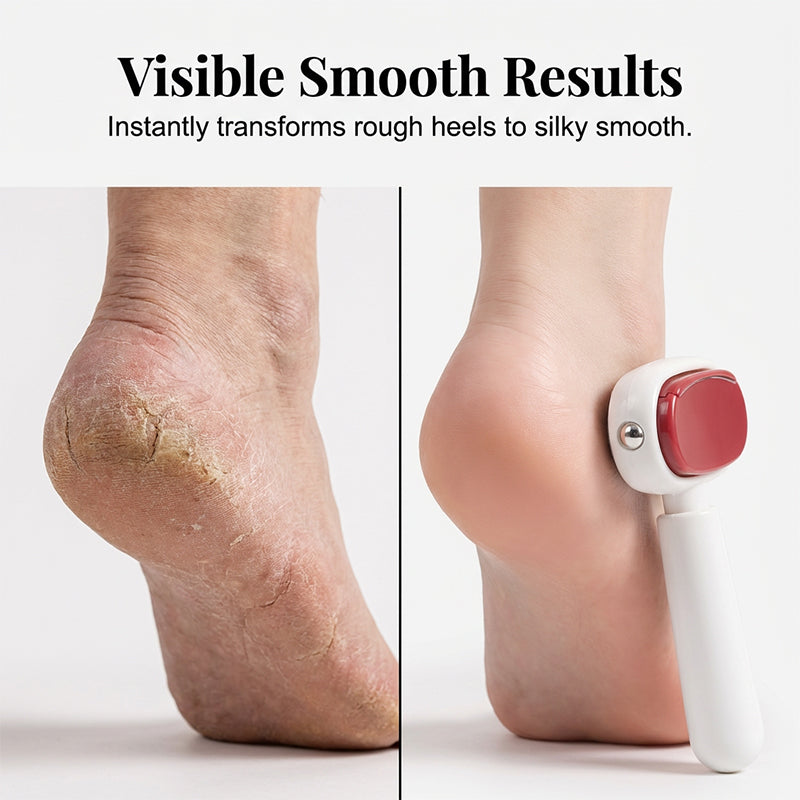 🦶✨50% OFF! 💨💅 Double-Sided Foot Scraper – Removes Calluses & Dead Skin Easily for Smooth, Baby-Soft Feet at Home. Over 41,728 Silky-Smooth Heels!✨