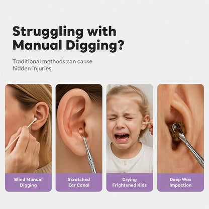 👂 Gentle Suction Ear Cleaner – LED-Guided Care Made Simple ✨