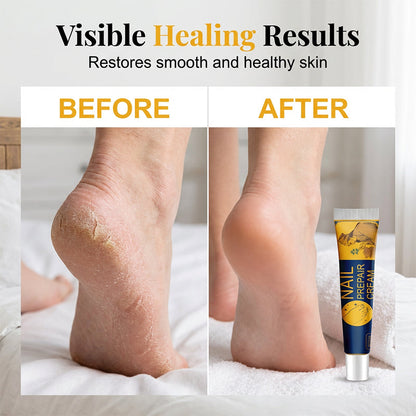 🦶 Intensive Moisturizing Foot Cream | Deep Hydration for Dry, Rough & Cracked-Looking Heels